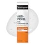 Neutrogena Anti-Pickel SOS Gel ab nur 3,15€ (statt 4,95€) – Prime